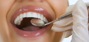 dental-cleaning-1