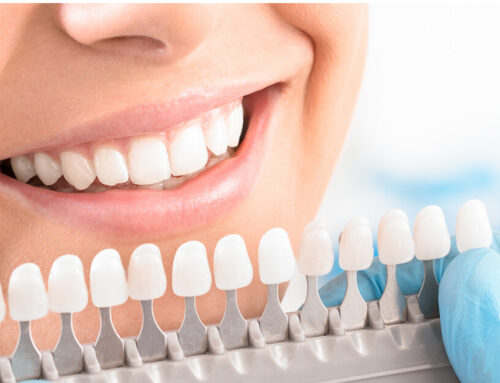 Cosmetic Dentistry Services In Airdrie