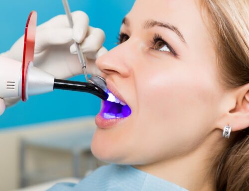 What Restorative Dentistry Services in Airdrie Includes