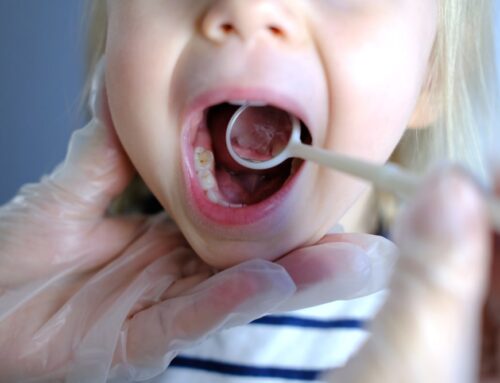 Do You Need to Fix Cavities on Baby Teeth?